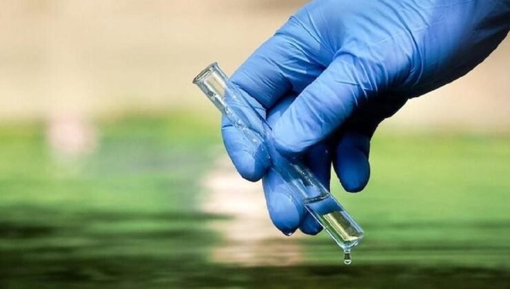 Lagos’ta Kolera Salgını: Ölü Sayısı 35’e Yükseldi