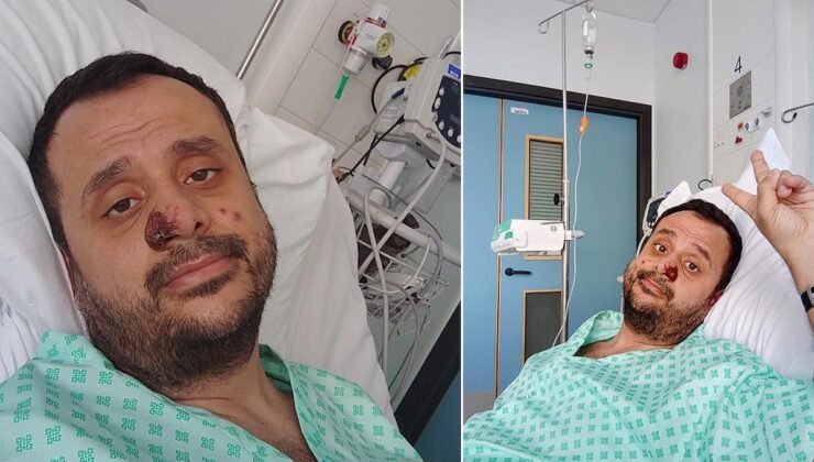 Dünya Sağlık Örgütü’nden M Çiçeği Salgını Alarmı