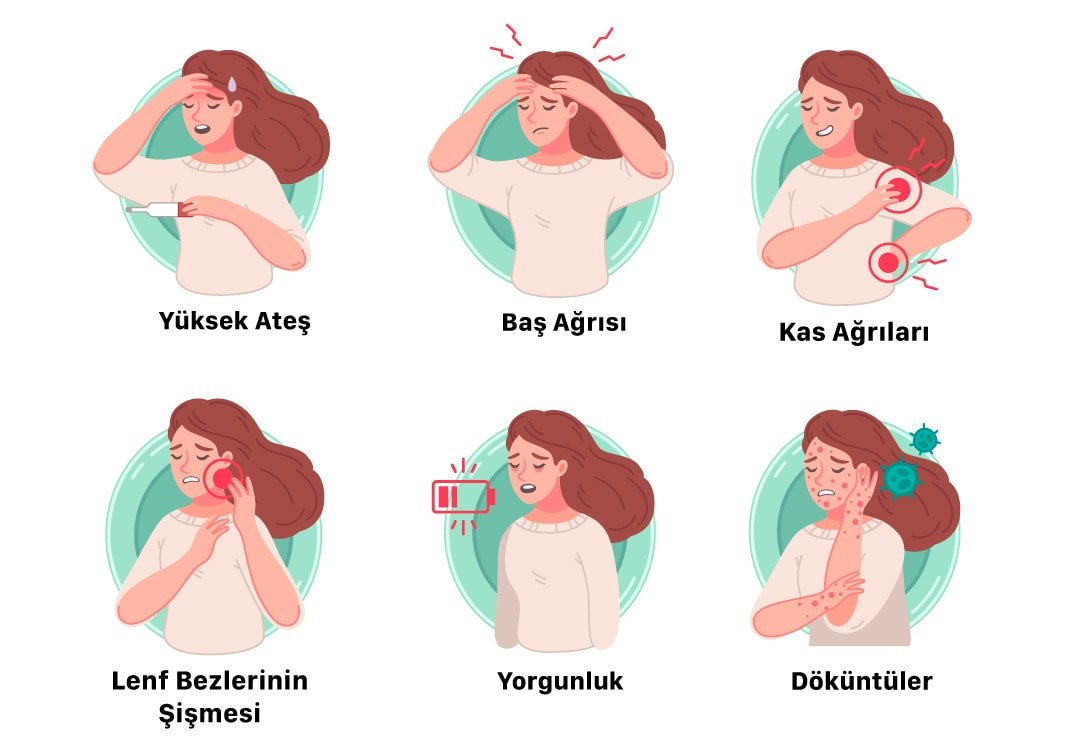 Maymun Çiçeği Hastalığı Türkiye'de Görüldü mü?