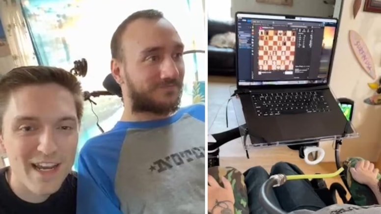 Neuralink: Elon Musk'ın Beyin Çipi Projesi