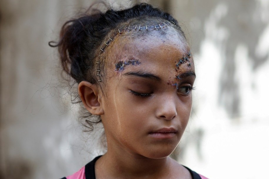 UNRWA'dan Gazze'deki Duruma Dair Açıklama