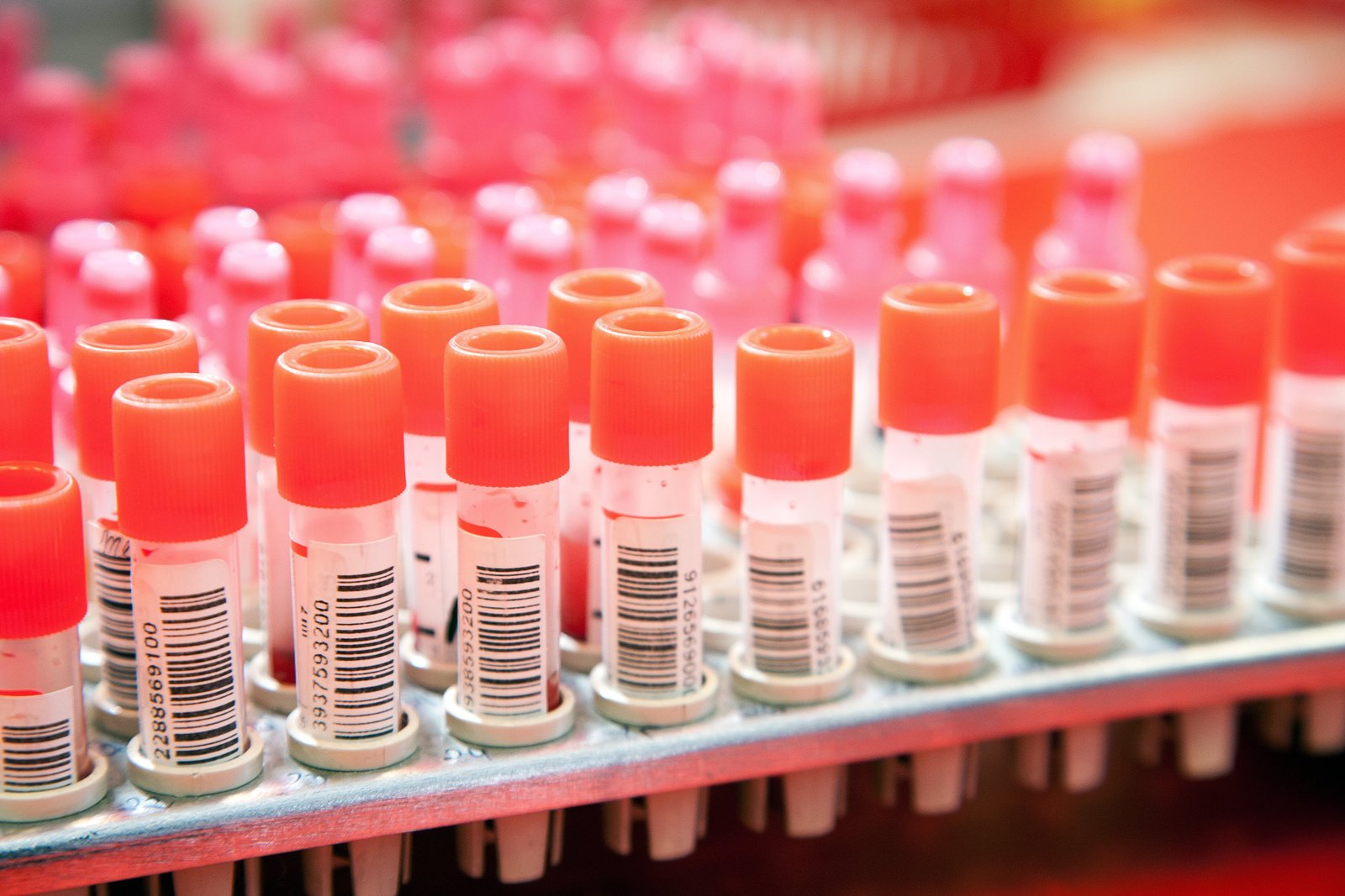 Öncesi, Sonrası ve Süreç