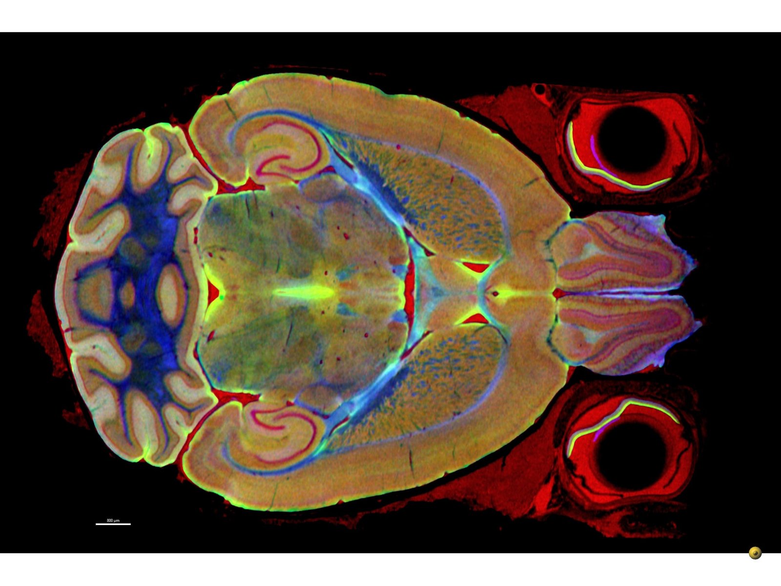 Beynin Hacmi Azaldı, Gücü Arttı