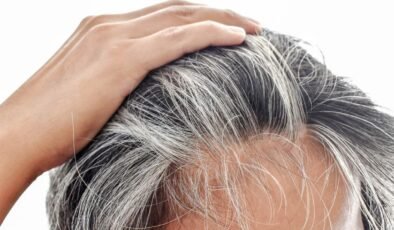 Saç Beyazlamasını Önlemenin Yolları