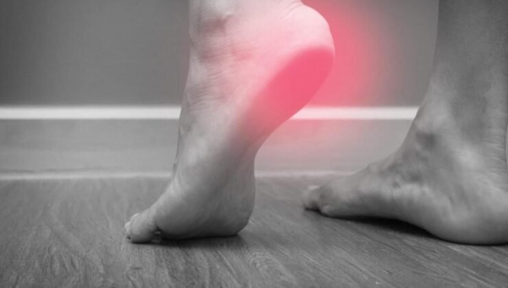 Topuk Ağrısı ve Topuk Dikeni Hakkında Bilinmesi Gerekenler