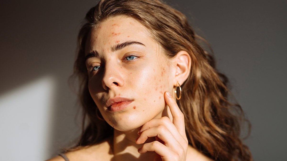 Şeker Tüketiminin Belirtileri