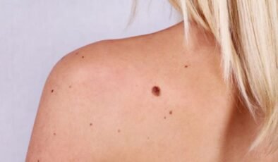 32. Ulusal Dermatoloji Kongresi Antalya’da Yapıldı