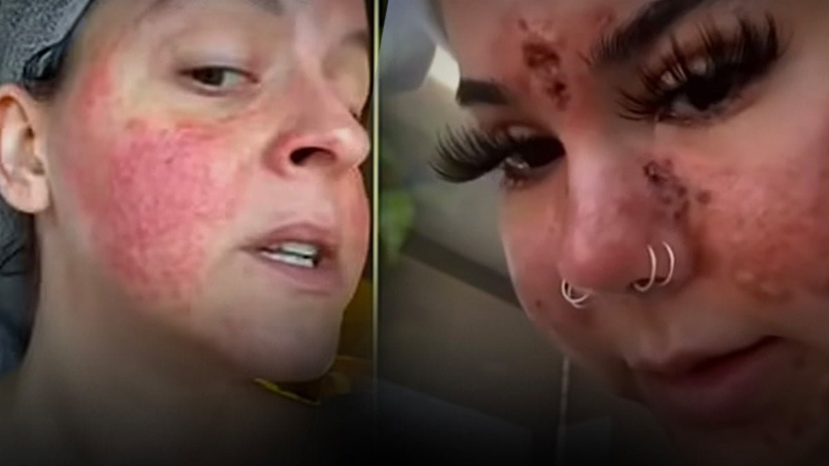 Kötü Koku ve Renk Değişimi