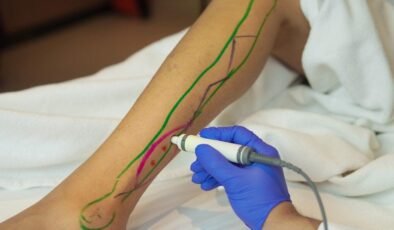 Doku Transferlerinin İyileşme Sürecine Etkisi ve Yöntemleri