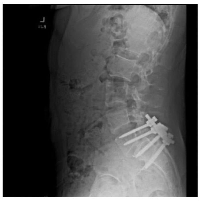 Luigi Nicholas Mangione'nin Brian Thompson'a Yönelik Suikasti