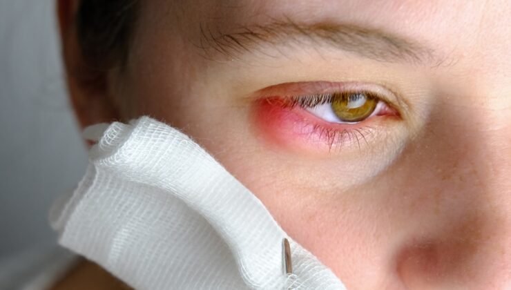 Oküler Onkoloji ve Göz Kanserinin Tedavi Süreci