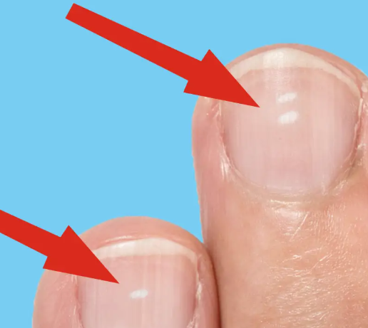 Kırmızı Avuç İçi