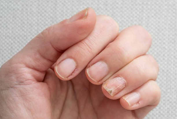 Şiş ve Yumru Eklem