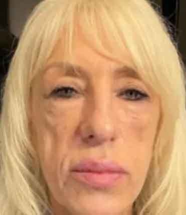 Andrea'nın Estetik Yolculuğu