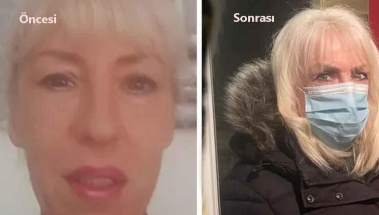 Andrea’nın Estetik Kliniği Deneyimi: Hayal Kırıklığı ve Sonuçları