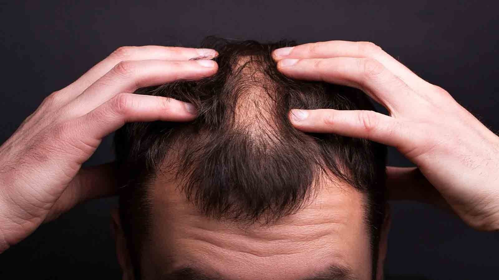 Aralıklı Oruç ve Saç Yenilenmesi Üzerindeki Etkileri