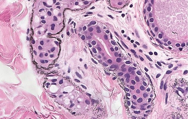 Hong Kong'da Nadir Bir Vaka: Arjiri Hastalığı