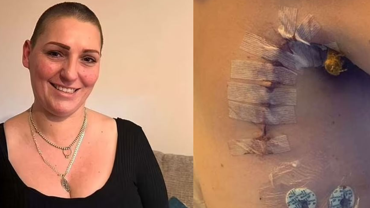 Kelly Heather'ın Melanomla Mücadelesi: Kanserin Geri Dönüşü ve Zorlu Süreç