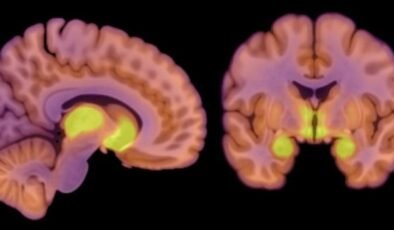 Anoreksiyanın Biyolojik Temelleri: Yeni Araştırma Bulguları