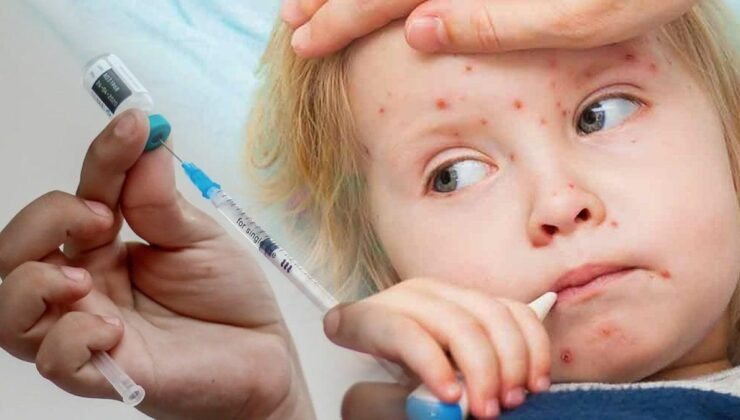 Teksas’ta Kızamık Salgını: Aşısız Bir Çocuk Hayatını Kaybetti