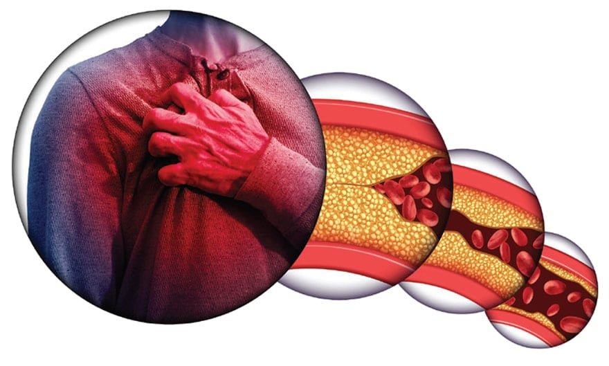 Resveratrol: Damar Sağlığını Genç Tutmanın Anahtarı