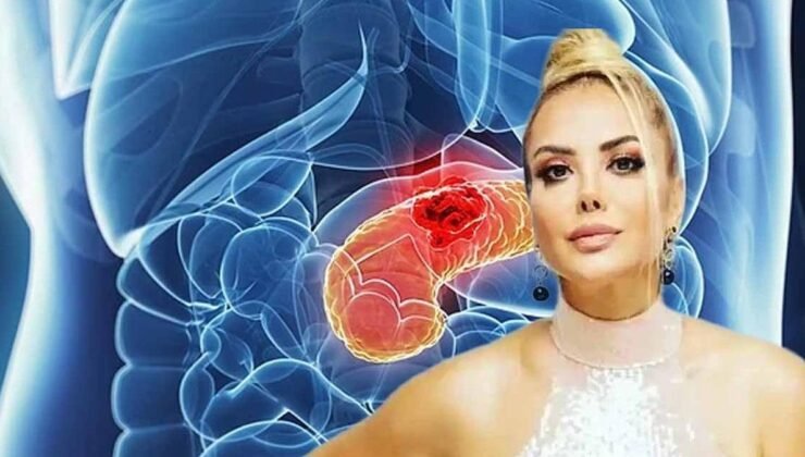 Pankreas Kanseri: Tanyeli’nin Vefatı ve Hastalığın Belirtileri