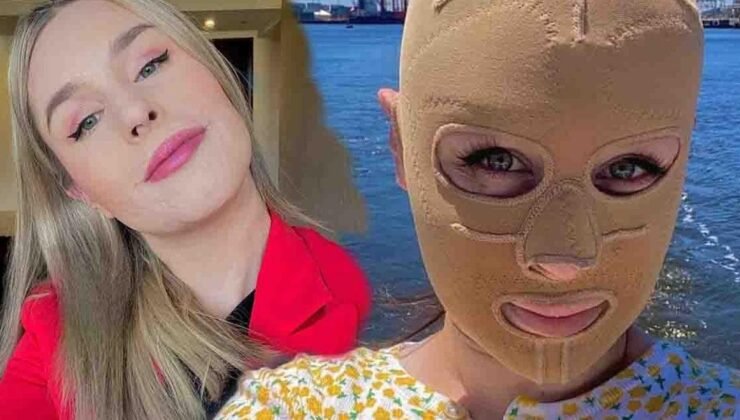 Volkanik Patlama Sonrası Hayatta Kalma Mücadelesi