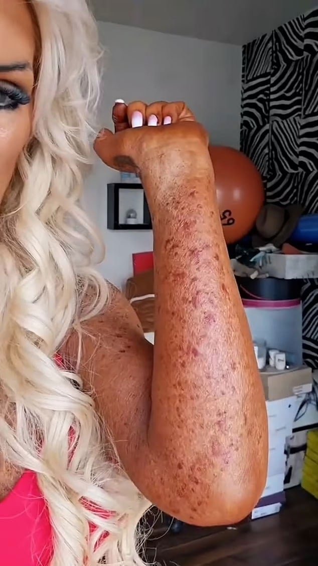 54 Yaşındaki Fitness Fenomeni Karrieann McDonnell'dan Solaryum Uyarısı