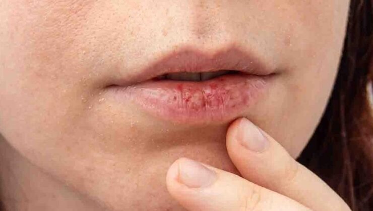 Dudak Renkleri ve Sağlık İpuçları