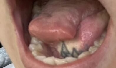 İngiltere’de Yaşayan Jessica Tappenden-Rowell’in Kanserle Mücadelesi