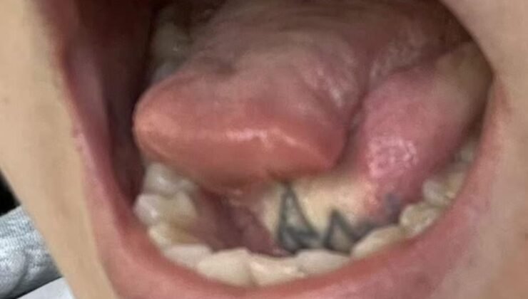 İngiltere’de Yaşayan Jessica Tappenden-Rowell’in Kanserle Mücadelesi