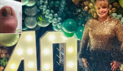 İngiltere’de Tek Başına Çocuk Büyüten Jennings’in Hayatını Değiştiren Tırnak Problemi