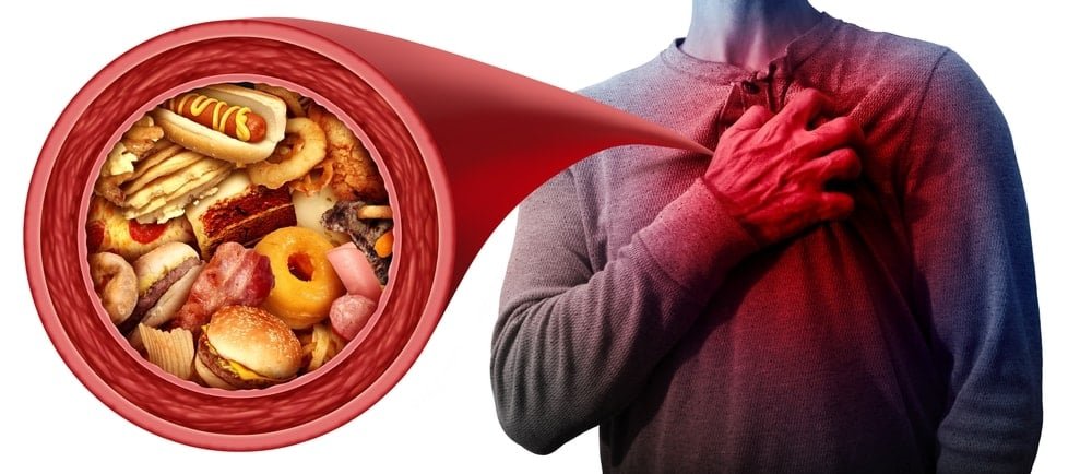 Kalp Krizi Nedir ve Nasıl Oluşur?