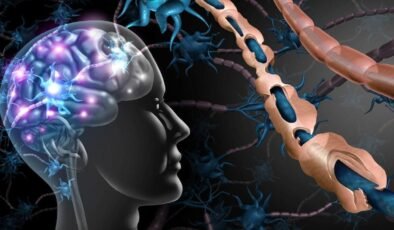 MS Hastalığında Güncel Bilgiler ve Uzman Tavsiyeleri