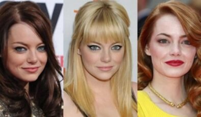 Nicole Kidman’ın Peruk Kazasından Sonra Gerçekleri Keşfedin