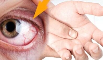 Kas Seğirmelerinin Nedenleri ve Doğal Çözüm Yolları