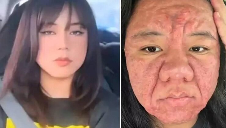 28 yaşındaki kadın bir günde 30 yıl yaşlandı: İşte nedeni