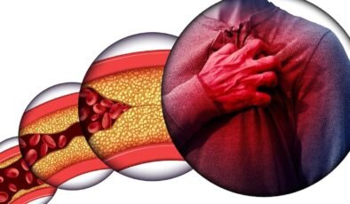 Kolesterol Nedir ve Yükselme Nedenleri ile Yönetimi