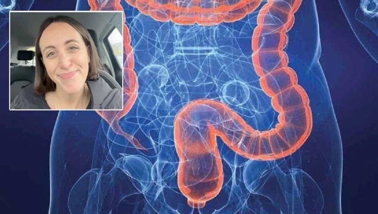 Gençleri Harekete Geçiren Kolon Kanseri Uyarıları: Belirtiler ve Yaşam Tarzı Değişiklikleri
