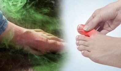 Kına ve Elma Sirkesiyle Ayak Sağlığı: Doğal ve Ekonomik Bir Anti-Miral Çözüm