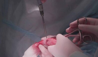 Bangkok’ta Sahte Cerrahın Eski Arabasında Yaptığı Tehlikeli Operasyonlar