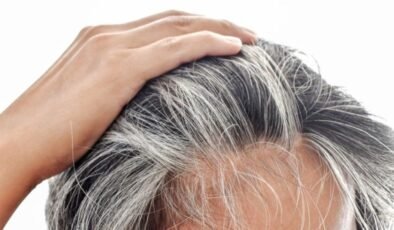 Genç Yaşta Beyazlaşan Saçlar: Genetik mi, Beslenme mi? Gerçeği Sizin İçin Derledik