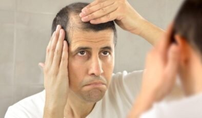 Saç Kıran Riski: Bereler ve Şapkalar Tarafından Bulaşan Tinea capitis Hakkında Uzman Uyarıları