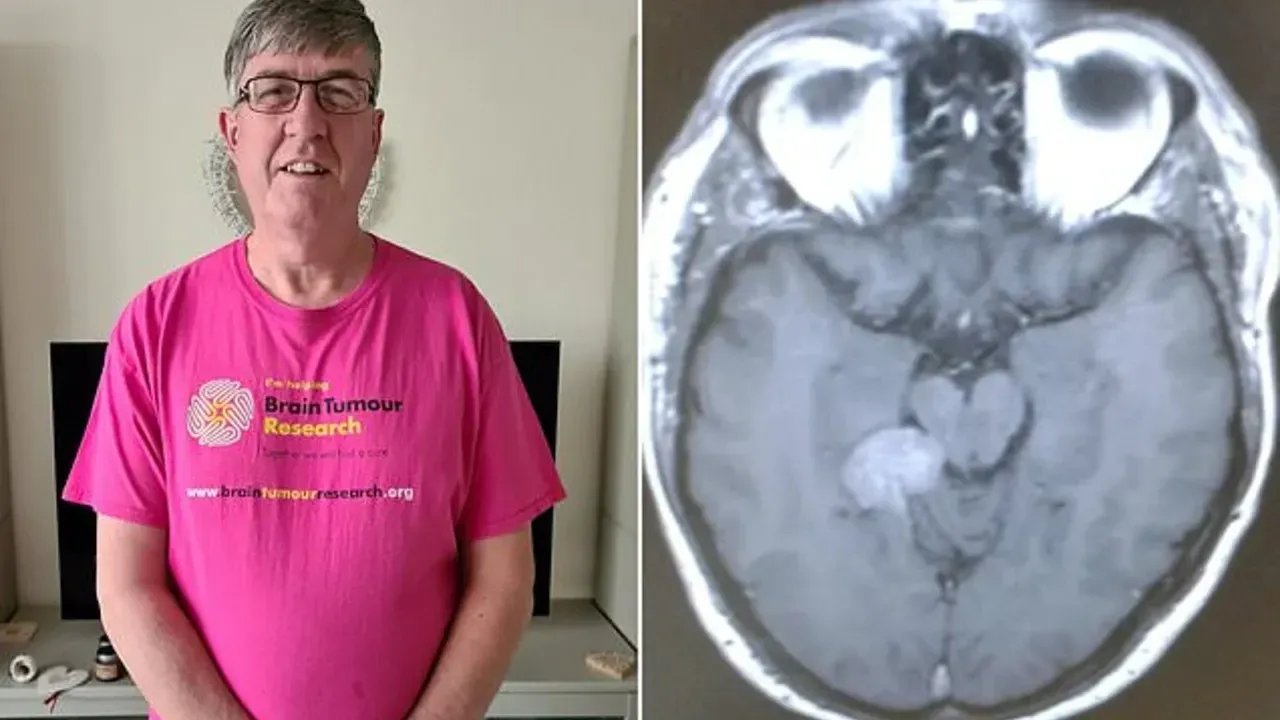 Günden Güne Artan Uyarı: Tümörün Gizli Riski ve 35 Bin Sterlinlik İleri Teknoloji Müdahalesi