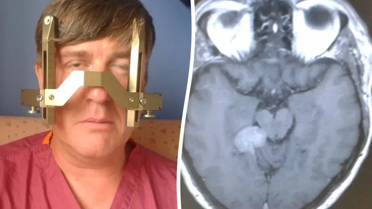 Günden Güne Artan Uyarı: Tümörün Gizli Riski ve 35 Bin Sterlinlik İleri Teknoloji Müdahalesi