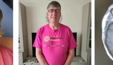 Günden Güne Artan Uyarı: Tümörün Gizli Riski ve 35 Bin Sterlinlik İleri Teknoloji Müdahalesi