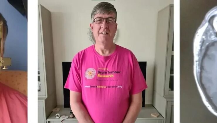 Günden Güne Artan Uyarı: Tümörün Gizli Riski ve 35 Bin Sterlinlik İleri Teknoloji Müdahalesi