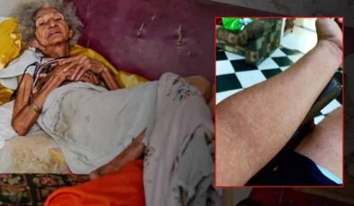 Küba’da Üçlü Salgın: Zombi Şehrine Dönüşen Adada Yaşanan Sağlık Çöküşü