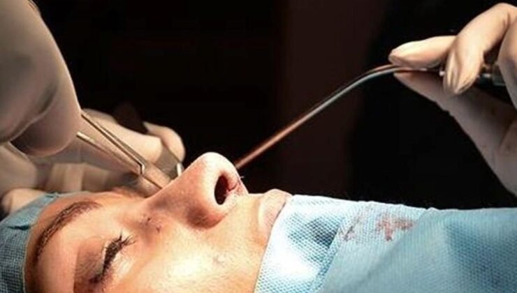 Rinoplasti: Fonksiyonel ve Estetik Dengenin İncelikleri