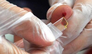 Tayland’da Keşfedilen Nadir Kan Grubu: Hibrit Enzimler ve Klinik Önemi